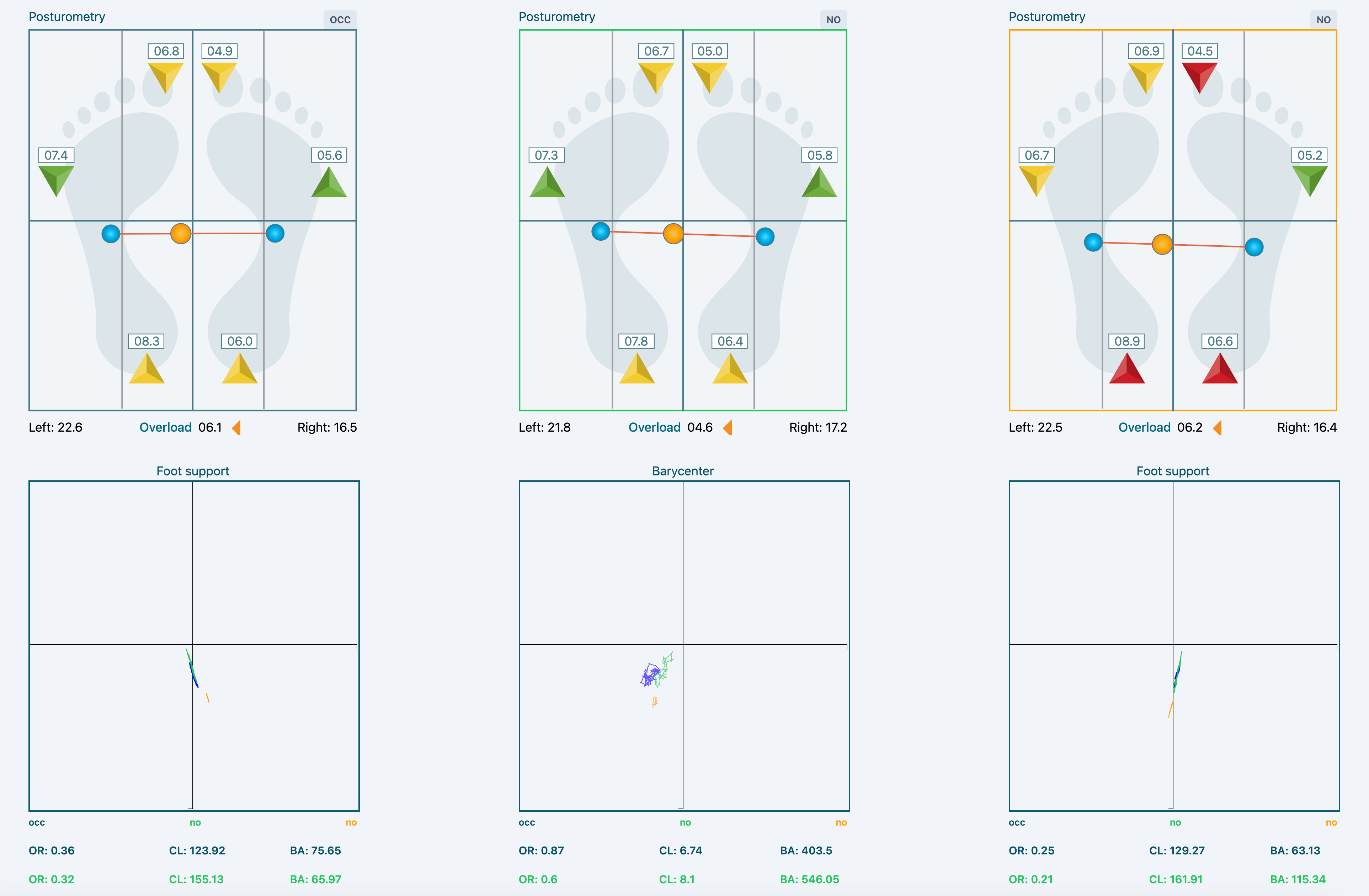 Posturometer diagnostic dashboard by Synaptic